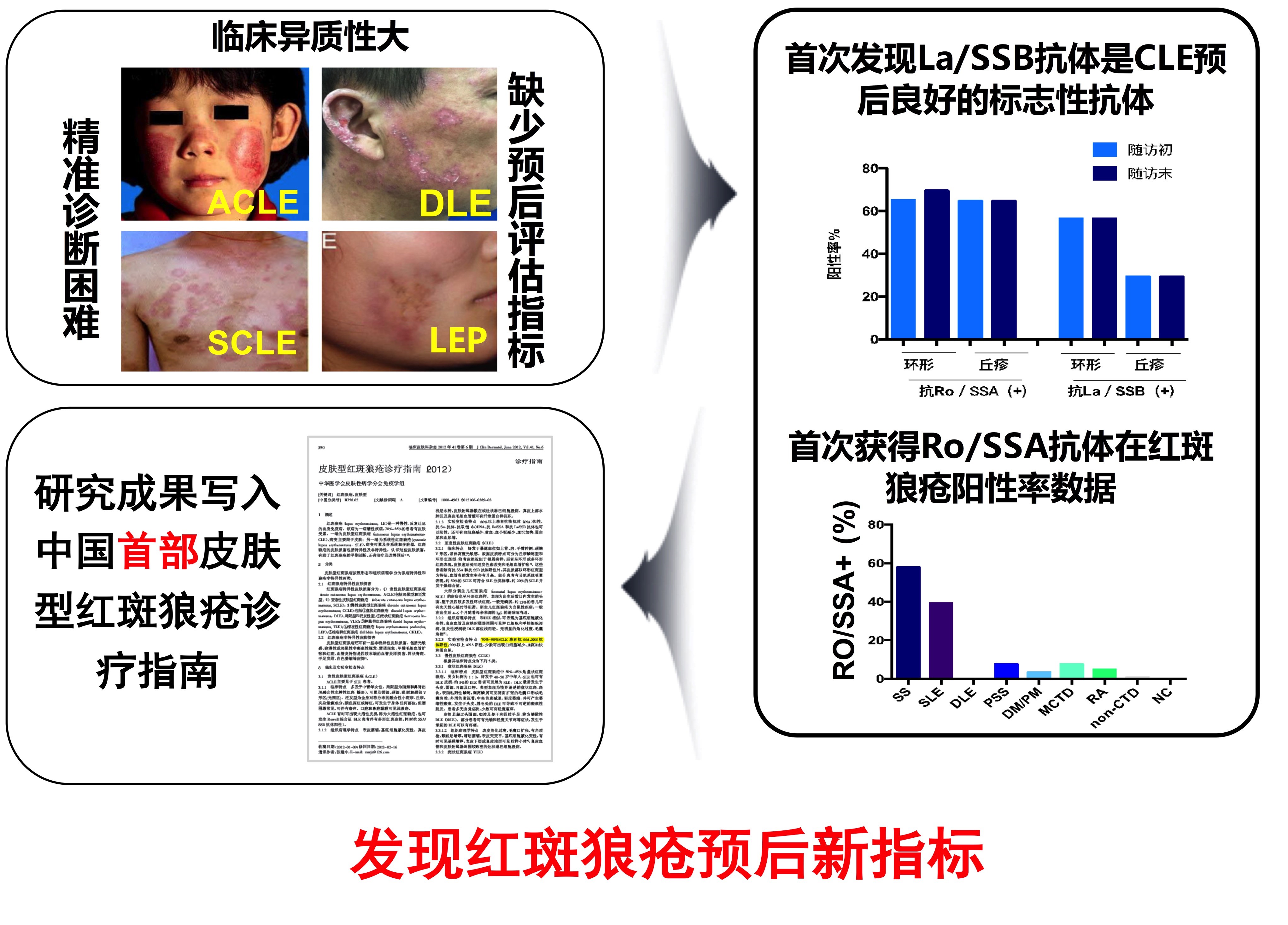 狼疮治疗新突破，最新疗法与创新方法探索